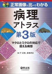 正常画像と比べてわかる病理アトラス マクロとミクロの対応で捉える病態 [本]