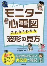 モニター心電図これならわかる波形の見方 オールカラー [本]