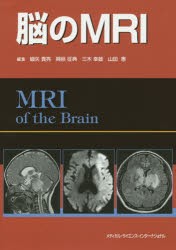 脳のMRI [本]