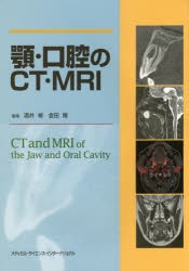 顎・口腔のCT・MRI [本]