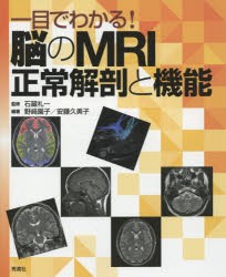 一目でわかる!脳のMRI正常解剖と機能 [本]