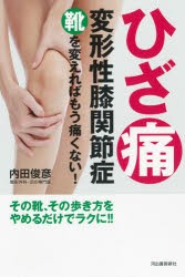 ひざ痛変形性膝関節症 靴を変えればもう痛くない! [本]