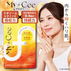 �y���z�����ɗD�ꎝ���^�Ō����I���z�r�^�~��C �T�v�� ���|�\�[�� �� ���O�� ���Z�x �����^ �A���t�@�����|�_ �R�G���U�C��Q10 �}�C�V�[ 