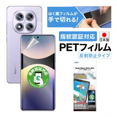 Xiaomi Redmi Note 14 Pro 5G tB JtB mOAʕیtB3 ˖h~ w} CA A`OA { A