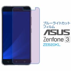 ASUS ZenFone 3 ZE520KL u[CgJbgtB t  یtB SF-ZE520KL-B [(lR|X)