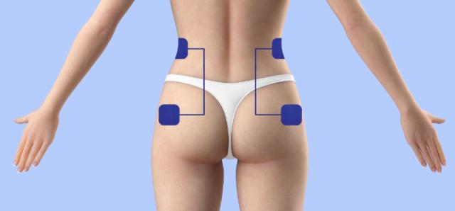 ルコエ ゴルフ 本体セット コンディショニング機器 筋電気刺激機器