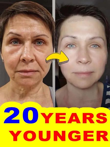 20歳若く 小じわなし