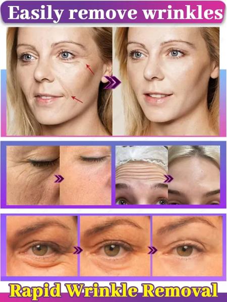 20歳若く 小じわなし