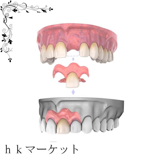 6本 カスタム 入れ歯 部分 取り外し可能 Dentellea 義歯 携帯便利 自然