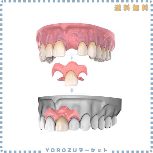 【2個入り】部分 入れ歯 カスタム｜Dentellea 自然に見える 義歯｜目立たない＆快適な装着感｜自宅で簡単型取り｜2本欠損に最適・男女兼