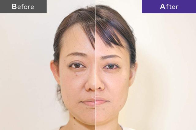 b.glen (ビーグレン) 【公式】QuSome リフト ＜マッサージ美容液＞ 60g / 2.12oz.