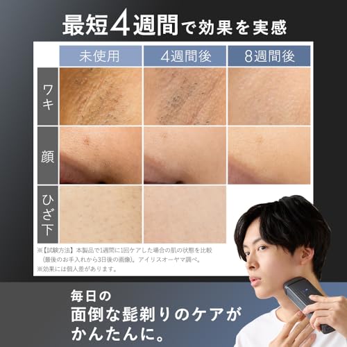 【MiCOLA】アイリスオーヤマ 脱毛器カテゴリ 光美容器 メンズ レディース 顔・VIO対応 髭 強力冷却 照射9段階モード 最大出力18J 照射回