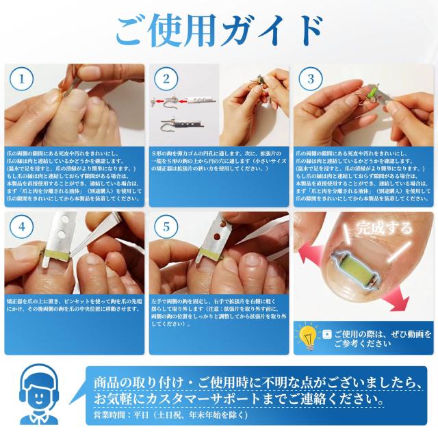巻き爪器具 2個入り 巻き爪 まきづめ 陥入爪 まきずめ 巻爪 器具