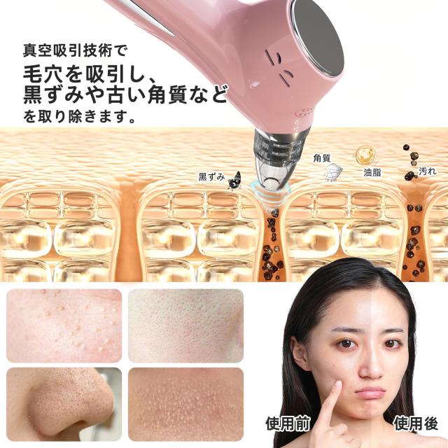 GUPAY 毛穴吸引器 毛穴洗浄 毛穴ケア 毛穴汚れ去除 角栓取り 毛穴 
