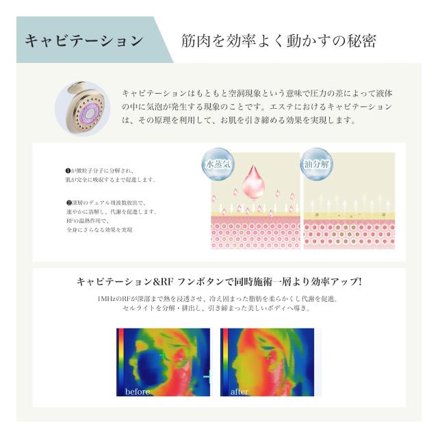 yete 美顔器 ボディ美容器 1台多役 複合美容器 超音波RF 5段階の強度