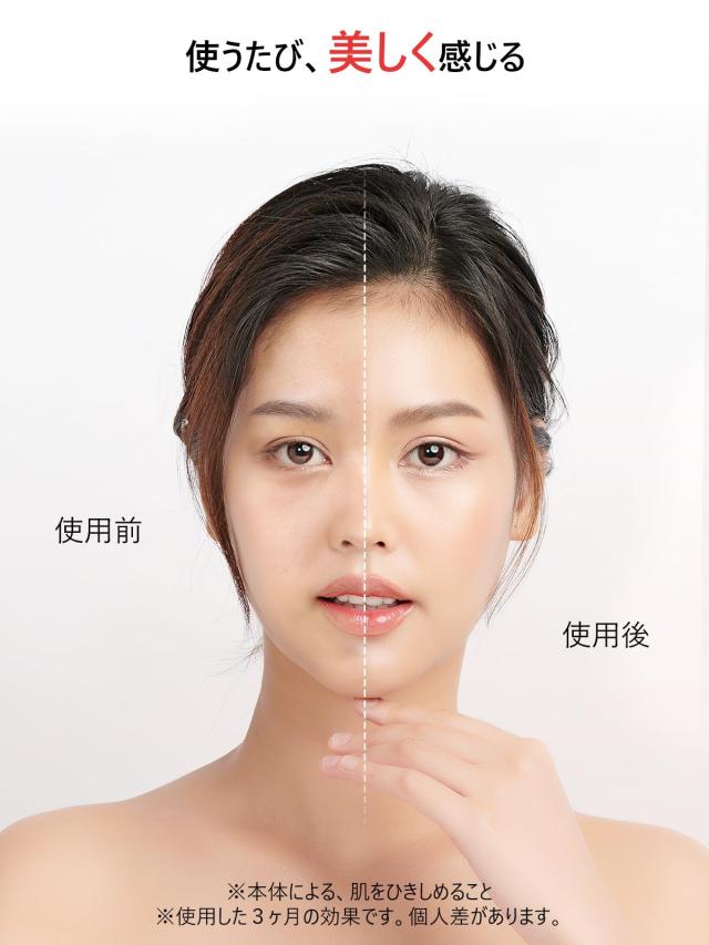 arboleaf 電気ブラシ 美顔器 EMS 充電 フェイス/頭皮/スキン 充電