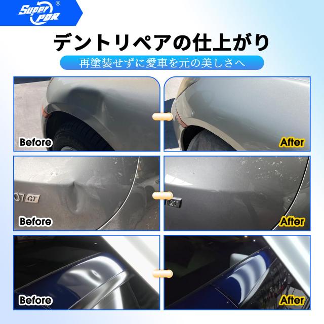 Super PDR デントリペアツールセット PDR用 車の凹み修理工具セット デントリペア 工具 凹み修復工具 自動車鈑金 塗装不要 デントリフタ_1