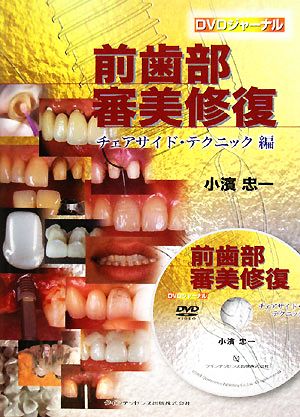 【中古】 前歯部審美修復　チェアサイド・テクニック編 ＤＶＤジャーナル／小濱忠一【著】