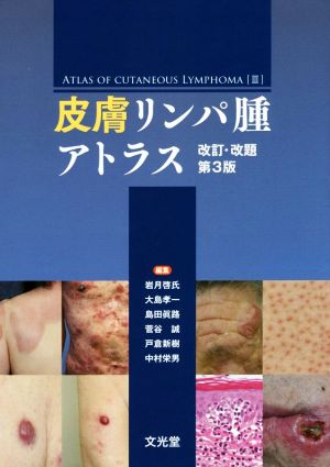 【中古】 皮膚リンパ腫アトラス　改訂・改題第３版／岩月啓氏(編者),大島孝一(編者),島田眞路(編者),菅谷誠(編者),戸倉新樹(編者)