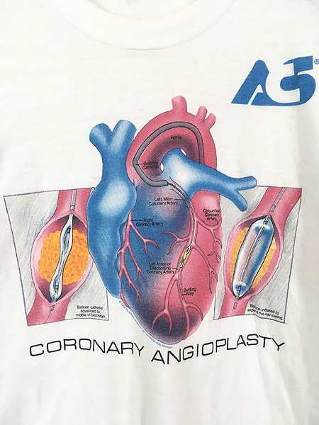 古着 80s 心臓 医学 手術 バイパス 臓器 アート Tシャツ M 古着の通販