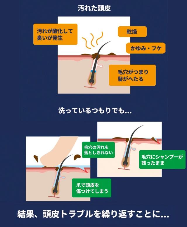 超美振動 スカルプブラシ P Up ソムリエ シャンプーブラシ ピーアップ テラヘルツ 櫛 くし クシ インバス用 頭皮ケアの通販はau Pay マーケット 渋谷トレンド Au Pay マーケット店 超美振動 スカルプブラシ P Up ソムリエ シャンプーブラシ ピーアップ テラヘルツ 櫛 くし クシ インバス用 頭皮ケアの通販はau Pay マーケット 渋谷トレンド Au Pay マーケット店