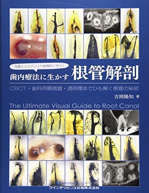 (中古品) 写真とエビデンスで歯種別に学ぶ! 歯内療法に生かす根管解剖