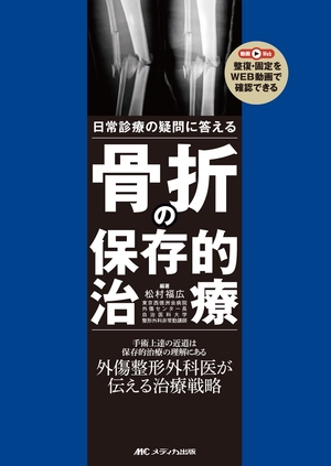 (中古品) 骨折の保存的治療: 日常診療の疑問に答える