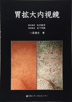 (中古品) 胃拡大内視鏡