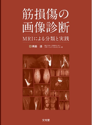(中古品) 筋損傷の画像診断: MRIによる分類と実践