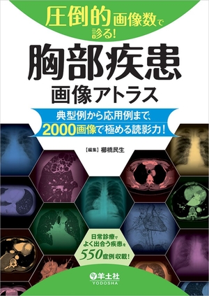(中古品) 圧倒的画像数で診る! 胸部疾患画像アトラス〜典型例から応用例まで、2000画像で極める読影力!