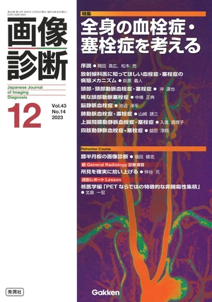 (中古品) 画像診断20212月号 Vol.43 No.14: 全身の血栓症・塞栓症を考える