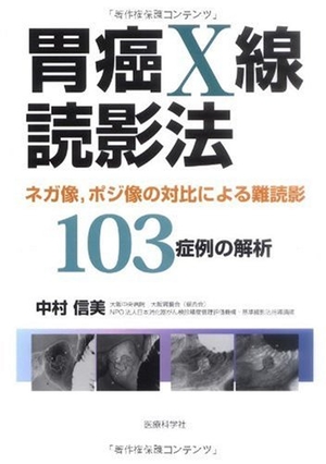 (中古品) 胃癌X線読影法─ネガ像,ポジ像の対比による難読影103症例の解析─