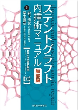 (中古品) ステントグラフト内挿術マニュアル 胸部編 ─ 動画を含む電子版付 ─