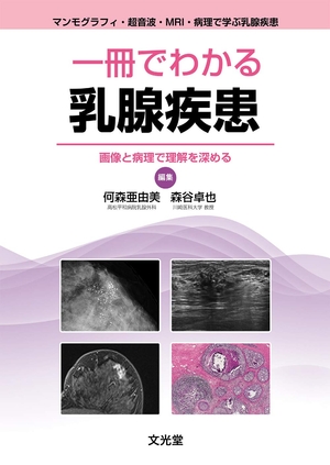 (中古品) 一冊でわかる乳腺疾患