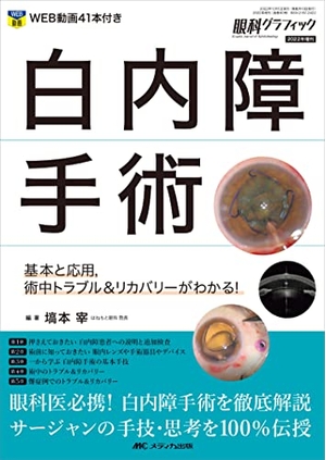 (中古品) 白内障手術: 基本と応用，術中トラブル＆リカバリーがわかる！ (眼科グラフィック202増刊)