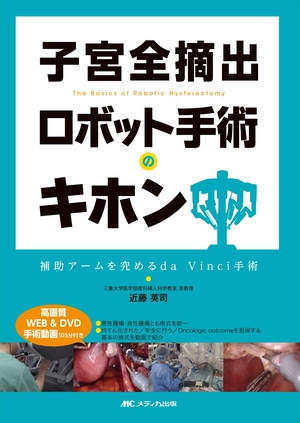 (中古品) 子宮全摘出 ロボット手術のキホン:補助アームを究めるda Vinci手術/高画質WEB&DVD手術動画105分付き