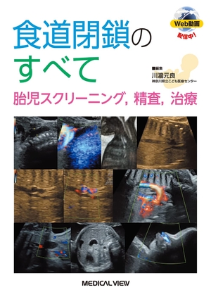 (中古品) 食道閉鎖のすべて−胎児スクリーニング, 精査, 治療