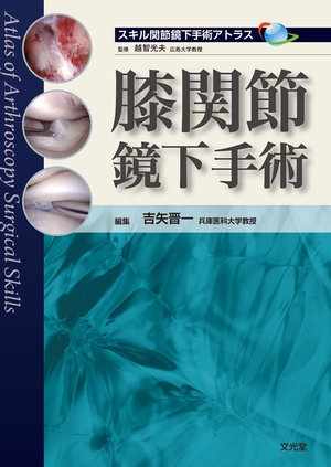 (中古品) 膝関節鏡下手術