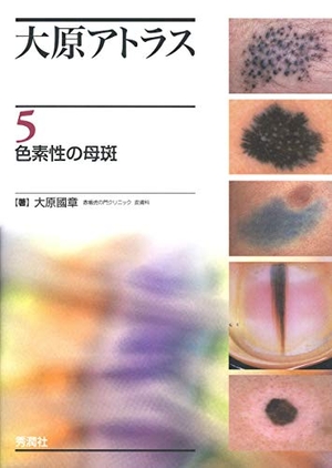 (中古品) 大原アトラス 5 色素性の母斑