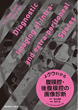 (中古品) よクウわかる腹膜腔・後腹膜腔の画像診断