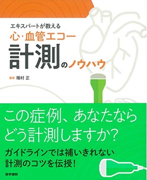 (中古品) エキスパートが教える 心・血管エコー計測のノウハウ