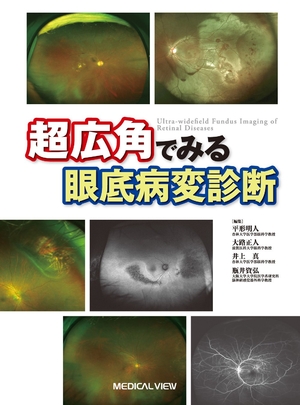 (中古品) 超広角でみる眼底病変診断−病巣を見逃さないために