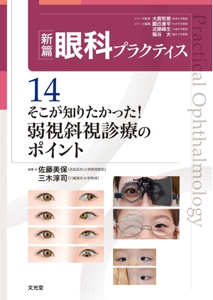 (中古品) そこが知りたかった!弱視斜視診療のポイント (新篇眼科プラクティス 14)