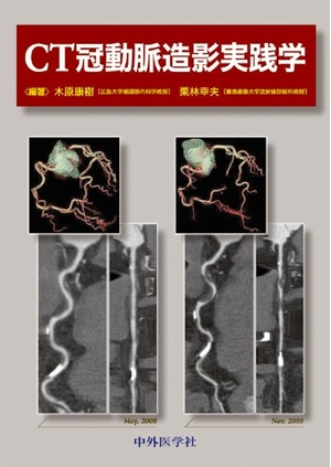 (中古品) CT冠動脈造影実践学
