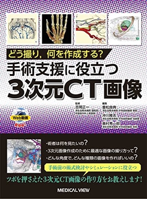 (中古品) どう撮り,何を作成する? 手術支援に役立つ3次元CT画像