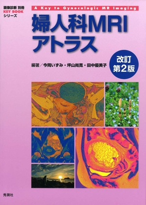 (中古品) 婦人科MRIアトラス 改訂第2版 (画像診断 別冊KEYBOOKシリーズ)