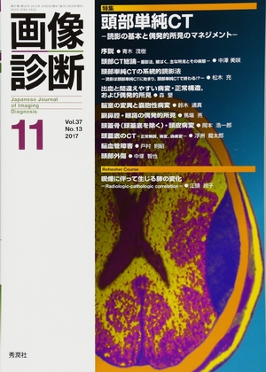 (中古品) 画像診断2017年11月号 Vol.37 No.13
