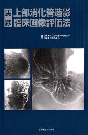 (中古品) 実践上部消化管造影臨床画像評価法