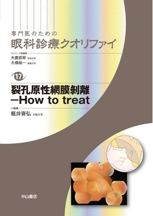 (中古品) 裂孔原性網膜剥離-How to treat (専門医のための眼科診療クオリファイ)