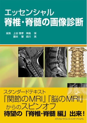 (中古品) エッセンシャル脊椎・脊髄の画像診断